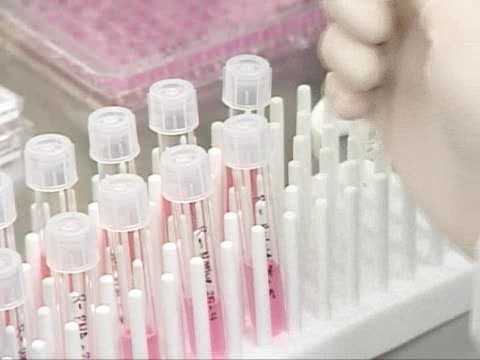 В Грузии увеличивается число заболевших вирусом A/H1N1