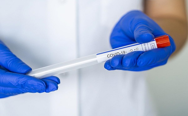 В Грузии выявлено 537 новых случаев коронавируса